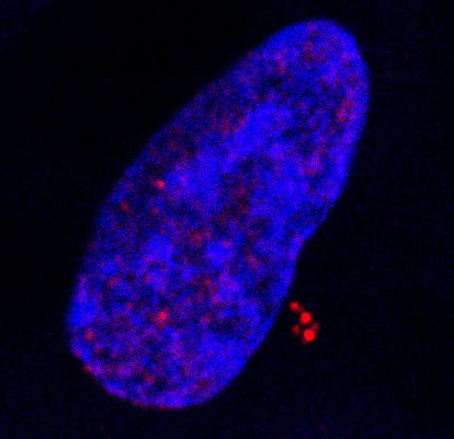 Infection par le virus d’Epstein-Barr : un nouveau mode de transformation cancéreuse